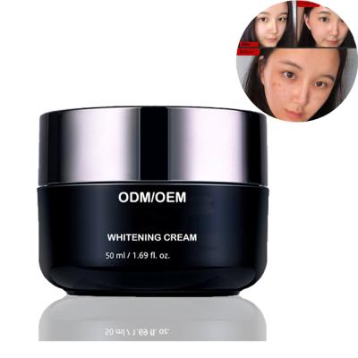 China kojic acid skin nourishing cream of the best whitening whitening cream for black skin for sale