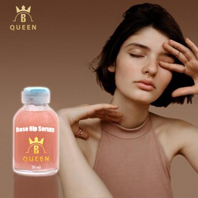 China Anti Aging Rose Hips Deep Moisturizing Face Whitening Serum for sale