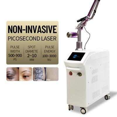 China Touch Screen Picosecond Pico Laser Tattoo Removal Equipment Q Switch Nd Yag for sale