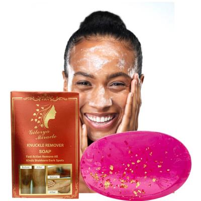 China Fast Basic Cleansing Action Remove Stubborn Dark Spots Skin Care Peeling Soap Brighten Melanin Whitening Nourish Skin Remove Dark Knuckle Soap for sale