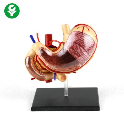 China PVC Advanced Gastric Anatomy Model For Advanced Teaching Removable for sale