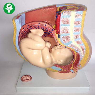 China Advanced PVC 4 Part Pelvic Section Model Human Anatomical Female Pelvic Female Model for sale