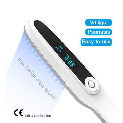 China Clinic home use mini psoriasis equipment 311nm medical device uvb treatment uv phototherapy lamp for vitiligo for sale