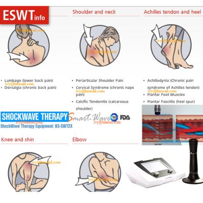 China Acupressure Shockwave Therapy / APST/AST Machine Extracorporeal Shockwave Therapy (ESWT) for Mortons Neuroma for sale