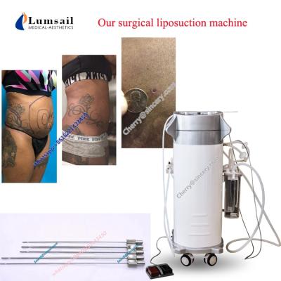 China weight loss fat reduce pal liposuction machine power assisted liposuction machines for body slimming for sale