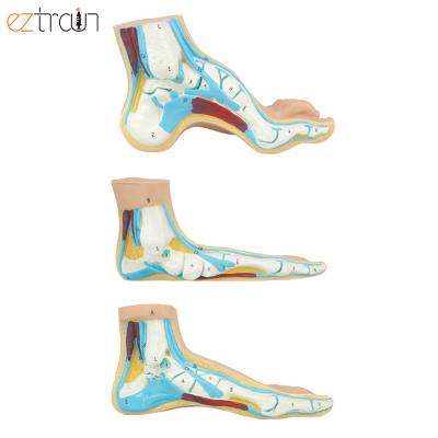 China Professional Education 3 Pcs Clinical Budget Set 3 LFA Full Arch Flat Arched Education Clinical Foot Anatomical Model for sale