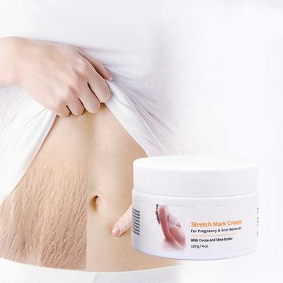 China Skin Revitalizer Private Label 100% Natural Vegan Postpartum Deep Scar Removal Anti Acne Stretch Mark Cream for sale