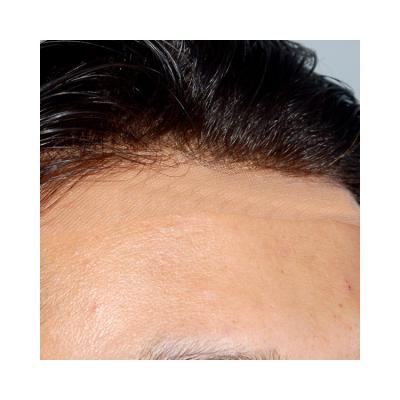 China Natural hairline hairpiece for men for sale