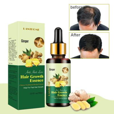 China Nourishing 30ml 7days Ginger Germinal Essential Oil Hair Growth Essence Hair Loss Treatment Serum Repair Liquid Dense Hair Fast Grow for sale