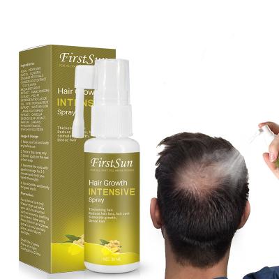 China Ginger Extract 30ML Private Label Hair Fall Hair Loss Treatment Organic Fast Effective Biotin Hair Growth Spray for sale