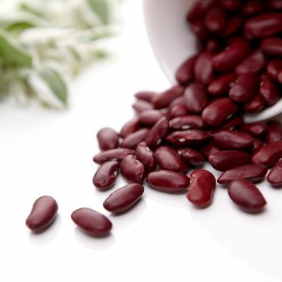 China Market price dry dry kidney beans of bush beans for sale