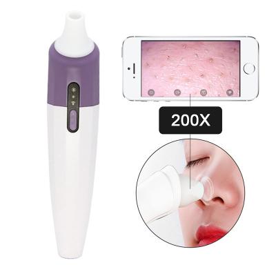 China 2021 Black Head APP Blackhead Remover Blackhead Remover Vacuum Pore Removal Prime Video Visible Pore Cleaner With Wifi Camera for sale