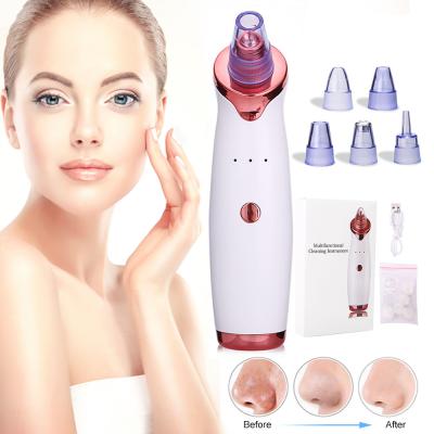 China Pore Cleaner Extractor De Espinillas Productos Mitesser-Entferner-Vakuum Des Belleza zu verkaufen