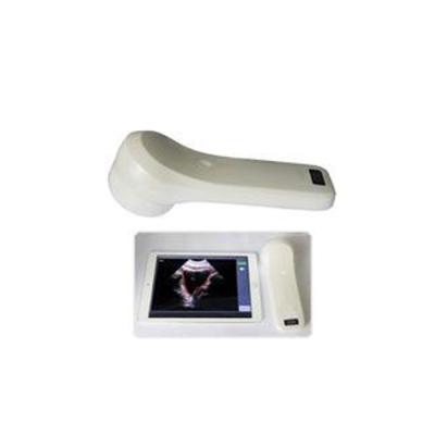 China 4D metal wifi bladder scanner wireless probe for sale