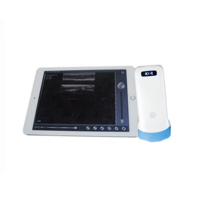 China Metal 128 Built-in 3.5mhz Wireless Ultrasound Convex Probe for sale