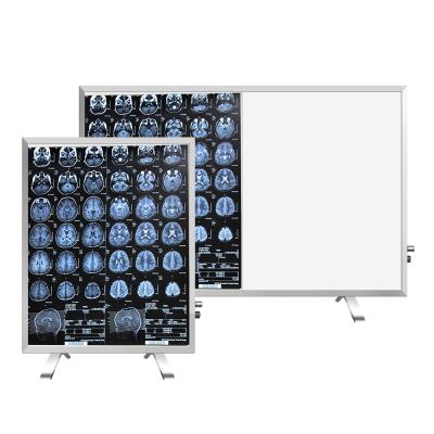 China Medical X-Ray Film Negatoscope Ultrathin Ultrathin Adjustable Optical Duplex LED Backlit Light Box for sale