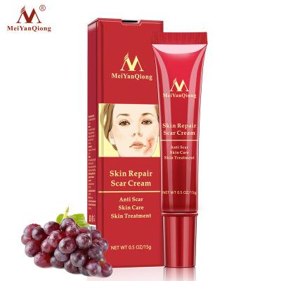 China Body Acne Scar Removal Cream Skin Repair Face Cream Acne Spots Acne Treatment Blackhead Whitening Creams Anti Scar Stretch Marks for sale