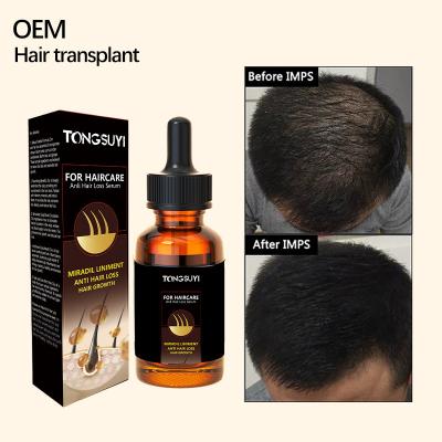 China Hair-Loss Prevention Hair Care Essence for sale