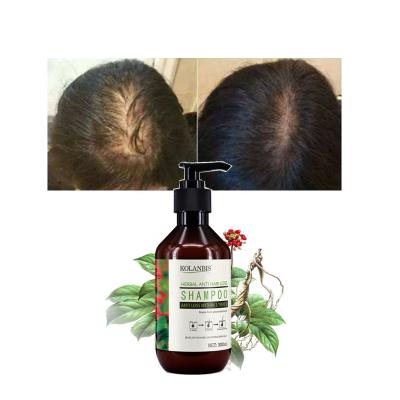 China KOLANBIS Loss Prevention Thicken Hair Shampoo Ginseng Root Extract Shampoo Balance Herbal Water And Oil 300ml for sale