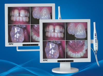 China Intra estructura oral del endoscopio de 17 pulgadas en cámara oral dental de la unidad/de las multimedias en venta