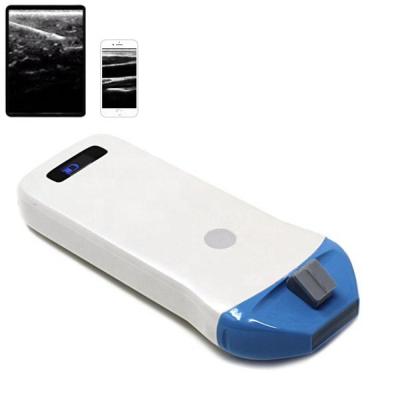 China Abdomen Sonostar BW PICC Portable Wireless Linear Ultrasound Probe for Biopsy Guide for sale