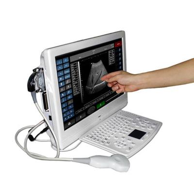 China UTouch-8 Urology 3D Touch Screen LCD Ultrasound Scanner Portable Ultrasound Machine for sale