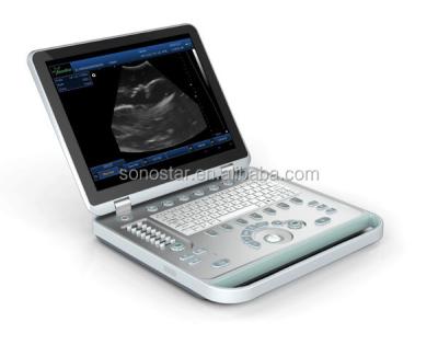 China 3D 4D Laptop Ultrasound Machine For Pregnancy SS-9 Model SS-9 for sale