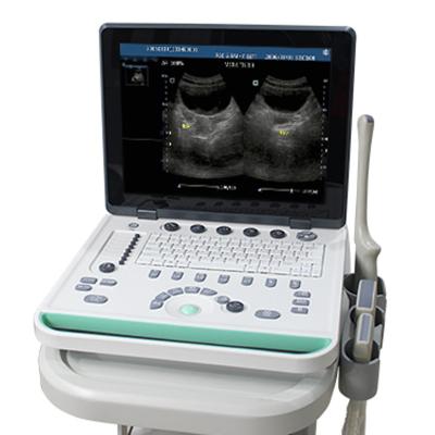 China Ultrasound Urology Ultrasound Scanner Machine Human Or Veterinary Portable Machine for sale