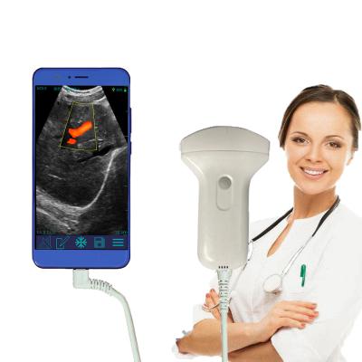 China USB / WIFI Plastic Sounder Type Ultrasound Scanner for sale