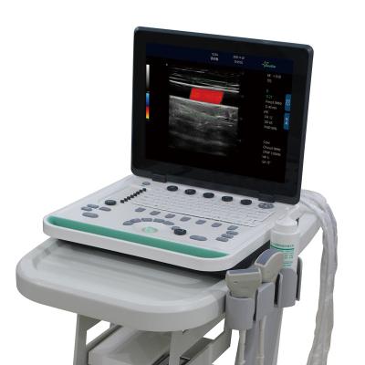 China C5Pre Portable Laptop Color 15 Inch LCD High Resolution Doppler Ultrasound Machine for sale