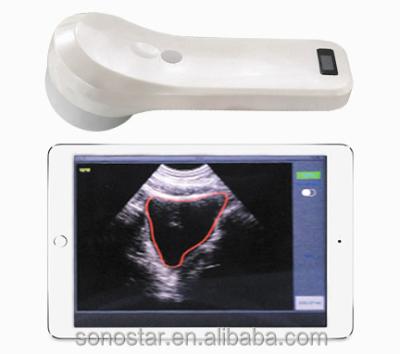 China BProbe-2 4D Wireless Probe Bladder Ultrasound Scanner BProbe-2 for sale