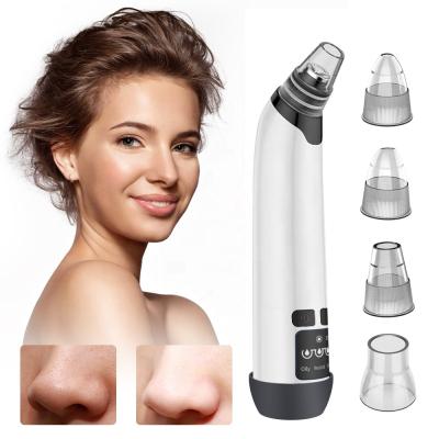 China Acne Treatment 4 Suction Heads Comedones Peep Deep Acne Blackhead Remover Vacuum Face Cleanser for sale