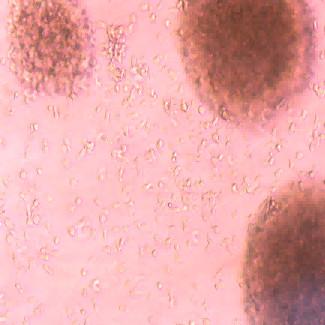 China Prevent Treat Tumors Immune Cells Improve Sub Health Conditions Types Of Immune Cells for sale