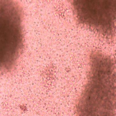 China Innovative Immune Cells Redefining Therapeutic Horizons for sale