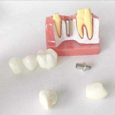 China Patient Education Models Dental Teeth Demonstration for sale