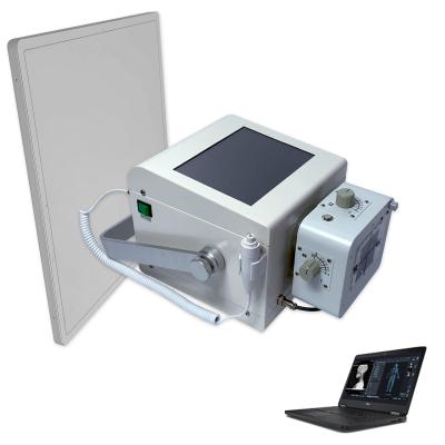 China Professional Metal Factory Wholesale High Quality Portable X Ray Machine Medical X Ray for sale