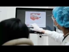 Intraoral Scanner