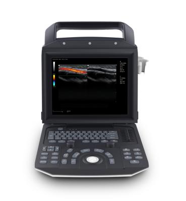 China Full Metal Color BT-UD93 2D Portable Doppler Ultrasound System Medical Ultrasound Instruments Portable Ultrasound Scanner Machine for sale