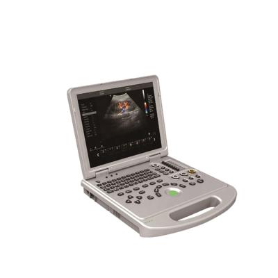 China 3.5MHz Convex Probe BT-UDC60PLUS 4D Laptop Portable Color Doppler Ultrasound Machine/Handheld Portable Color Ultrasound System for sale