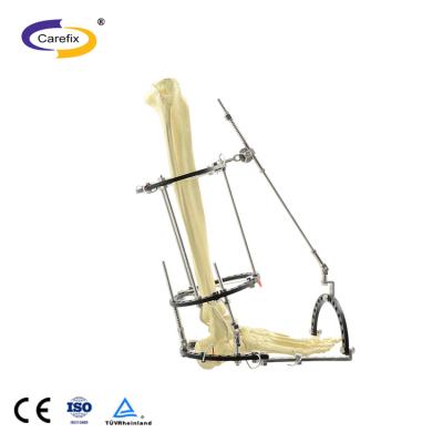 China CareFix 2/3 Ring fixator CE medical standard orthopedic external fixation 3d printer Ring for sale