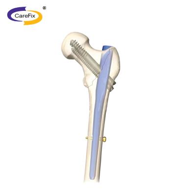 China Metallic femur and tibia engaging the IN4 intramedullary nail for sale