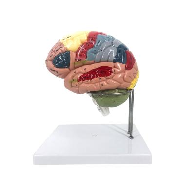 China Detachable Human Medical School Brain Model Cerebral Anatomy Cerebrovascular Artery Neurology Teaching for sale