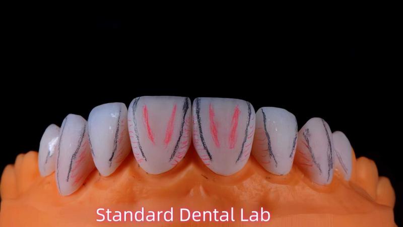 Проверенный китайский поставщик - Standard Dental Lab Co., Limited