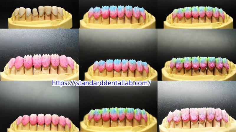 Проверенный китайский поставщик - Standard Dental Lab Co., Limited