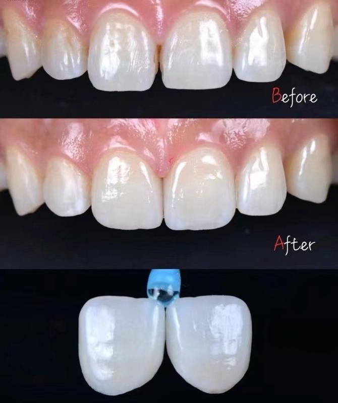 Проверенный китайский поставщик - Standard Dental Lab Co., Limited