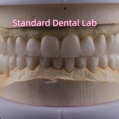 China Laboratório Dentário Arco Completo Zirconia Coroas de Porcelana PFZ Coroa ISO FDA CE à venda