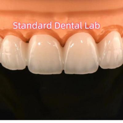 Cina Circonia Crowns Bridge Dental Lab con porcellana stratificata in vendita