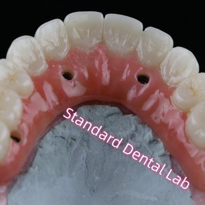 China Dental Implant Crown PFZ Porcelain Layered Zirconia Screw Retained With Pink Gum for sale