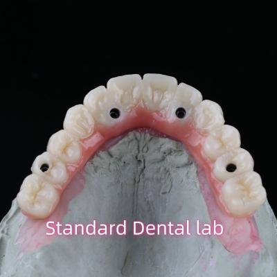 China Porcelain Zirconia Dental Implant Bridge Professional High Esthetics With Pink Gum for sale