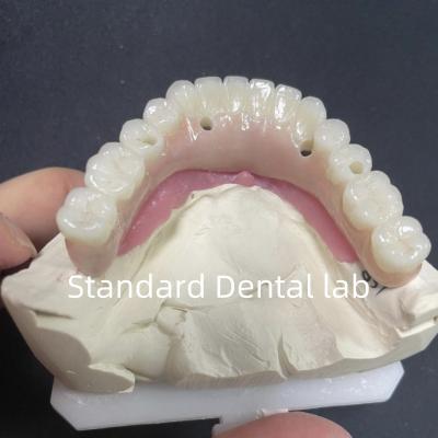 Cina Restauro estetico tutti su 4 impianti dentali zirconia ipoallergenico in vendita